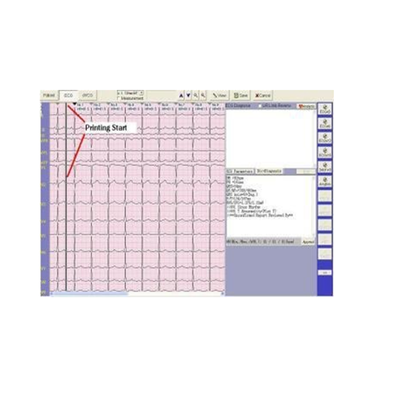 ECG  Software