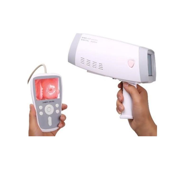 HKN-2000 Handheld Video Colposcope