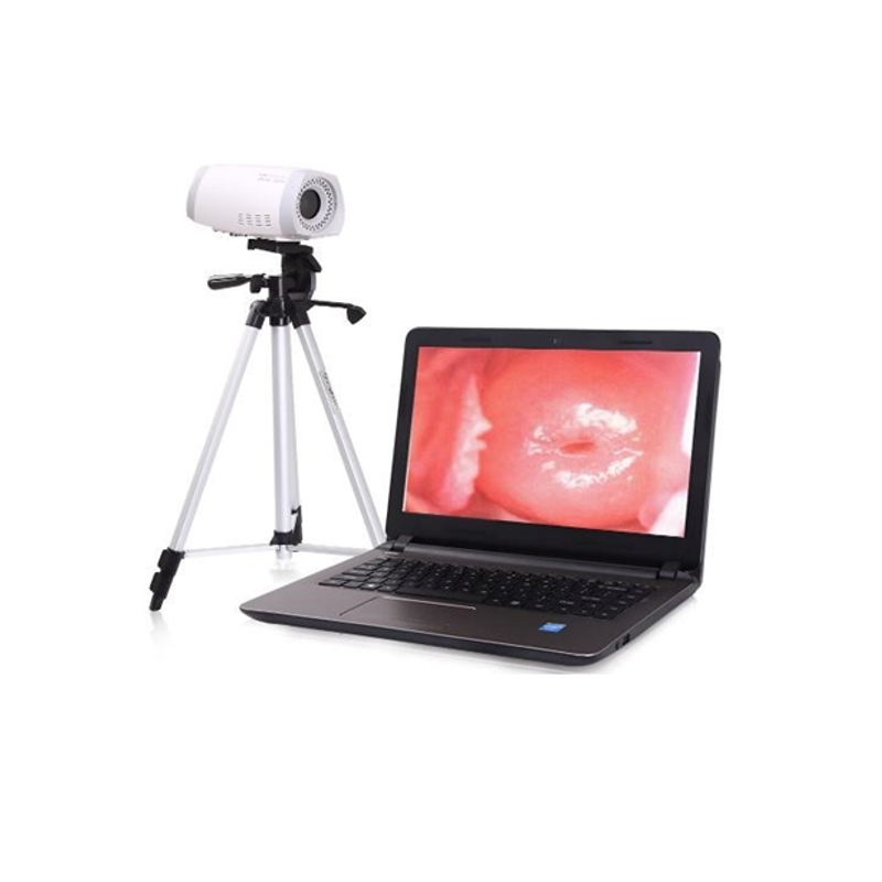HKN-2100 Portable Colposcope
