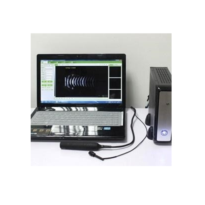 HO-200 Ophthalmic A/B ultrasound box scanner